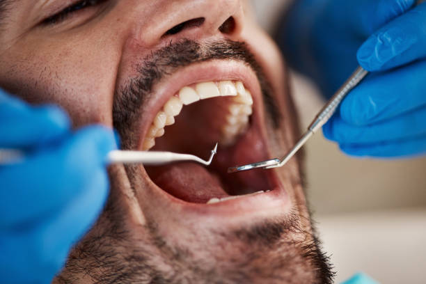 Best Urgent Dental Care for Toothache in Danville, IA