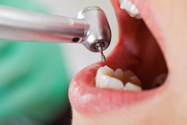 Best Broken or Cracked Tooth Emergency Dentist in Danville, IA